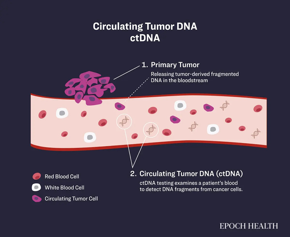 Doing Nothing: An Unexpected and Possible Lifesaving Cancer ‘Treatment ...